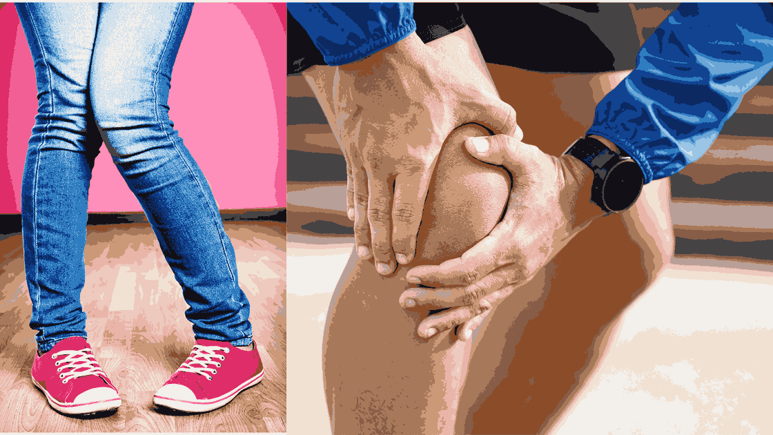 Flat Feet, Knock Knees & Bow Legs: What’s Normal and What’s Not