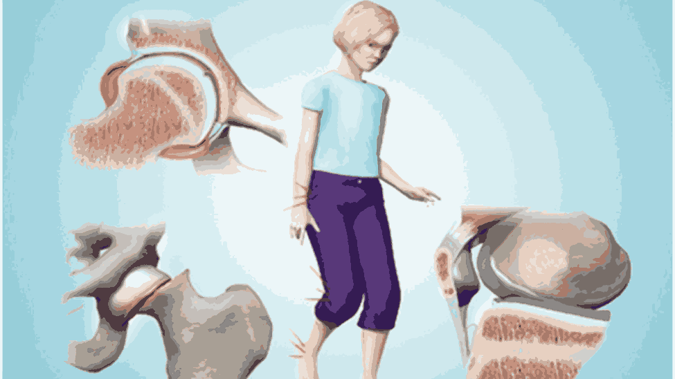 Is My Child’s Limp Normal or a Cause for Concern?