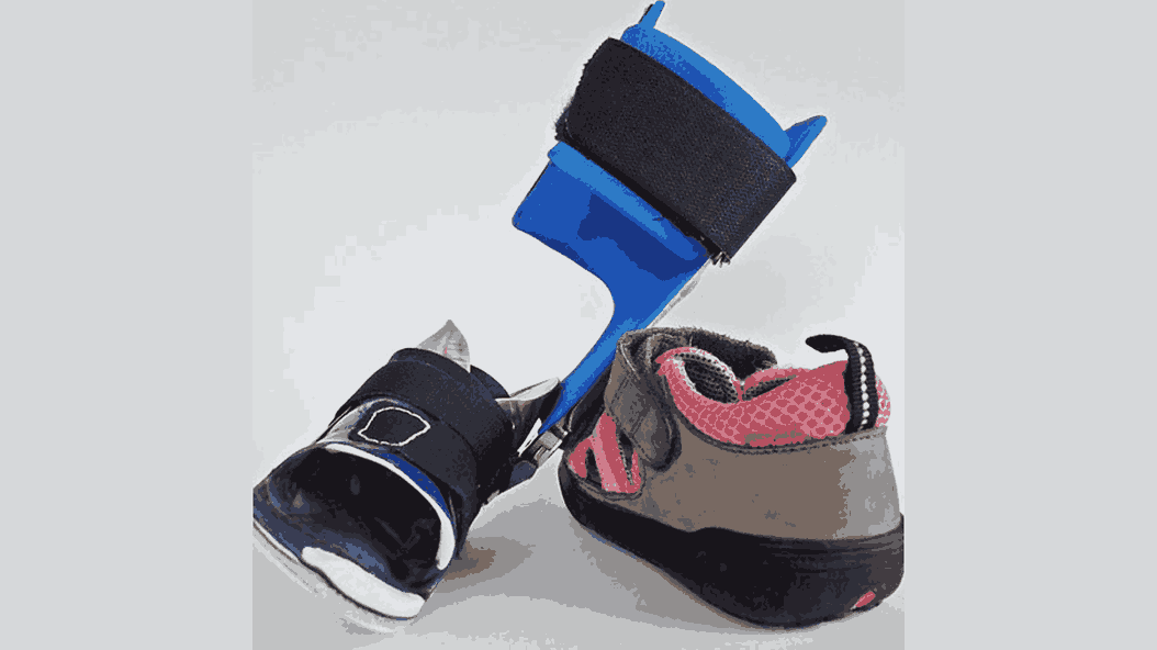 The Role of Bracing in Pediatric Orthopedic Treatment