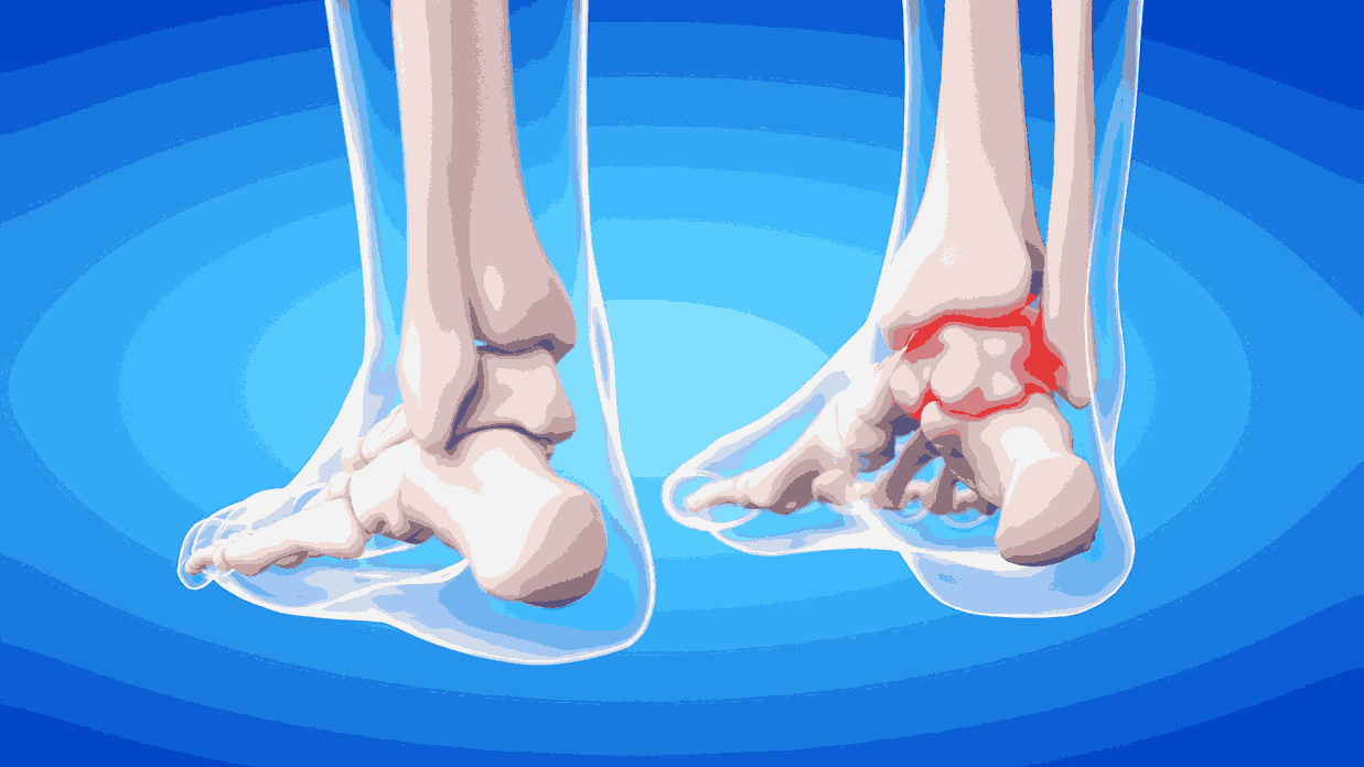 Simple Home Remedies for Minor Joint Pain in Children