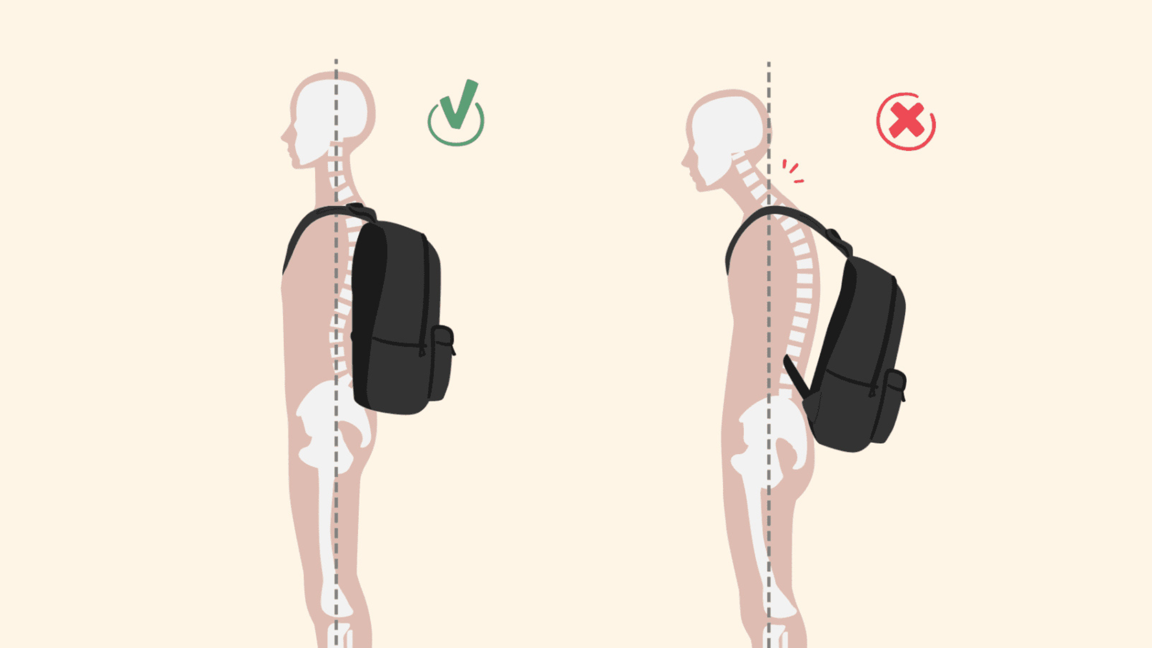Can Heavy School Bags Damage Your Child’s Spine?
